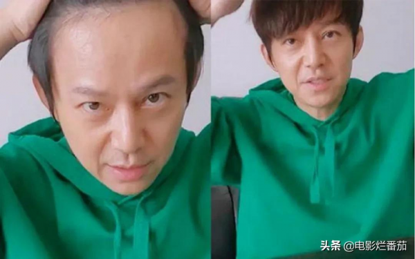 “禿頂”危機的10大男神，有人29歲髮際線堪憂，有人常年戴假髮套