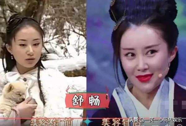 被“美容針”摧殘的女星，戚薇笑都不自然，舒暢真成“天山童姥”