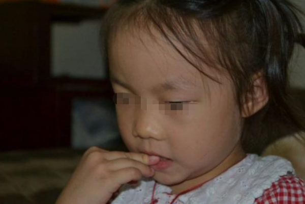 孩子嘴唇裂口又出血，還忍不住撕嘴皮，大夫的處理方式有些意外