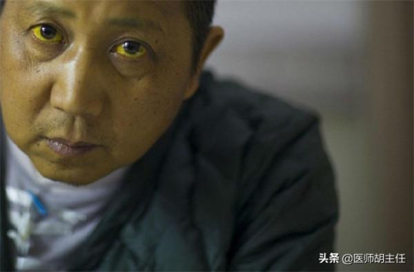 為何體檢時肝功能正常，結果卻查出肝癌晚期？2個檢查儘量別省