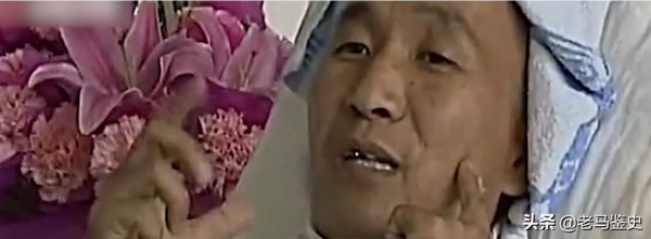 雲南30歲男子口臭駭人，只因&quot;腦中藏10釐米長刀&quot;，最終結局如何？