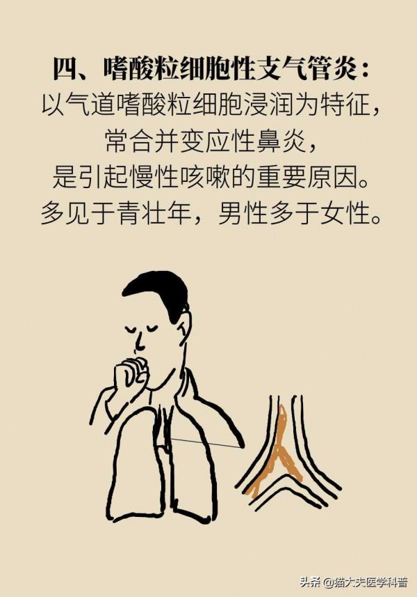 長期慢性咳嗽怎麼回事？（上）