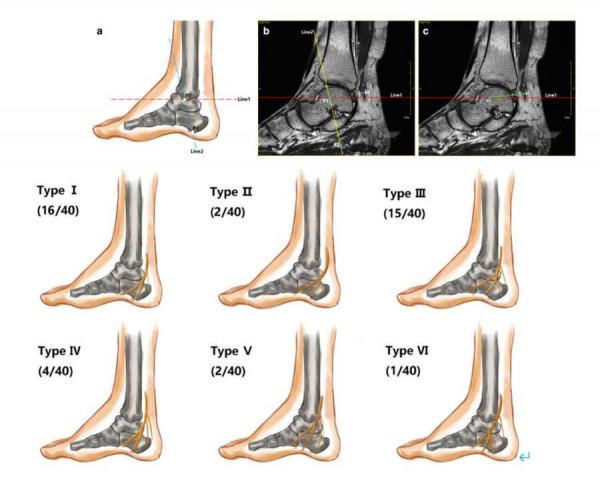關注！山東省精神衛生中心神經影像學研究取得重大進展