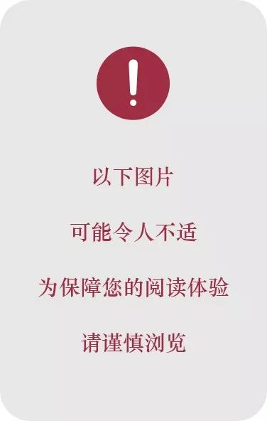 耳朵進了東西怎麼辦？