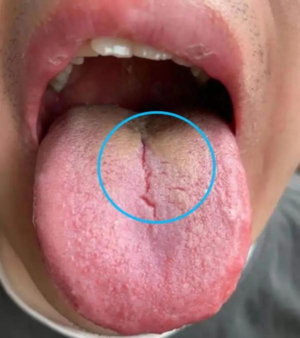 起床後總是口苦？是膽囊出了問題嗎？