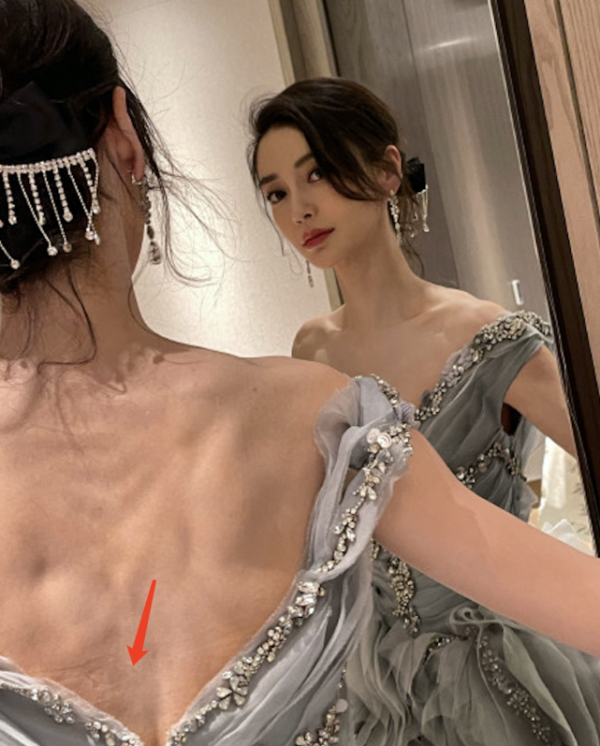 楊穎後背瘦到骨頭凸顯，看清面板狀態後，原來沈夢辰說的都是真的