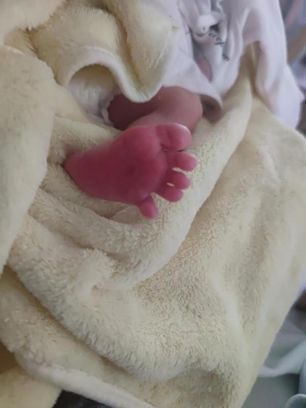 吐了整個孕期的閨蜜，小孩36+4出生了