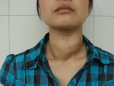 45歲後，進入“疾病爆發期”？醫生：若有五個跡象，建議早做檢查