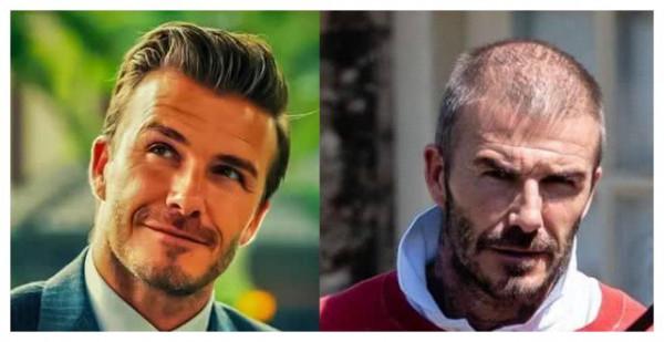 “禿頭之殤”?劉海兒的減齡？何炅Lisa沈夢辰離不開開門紅？