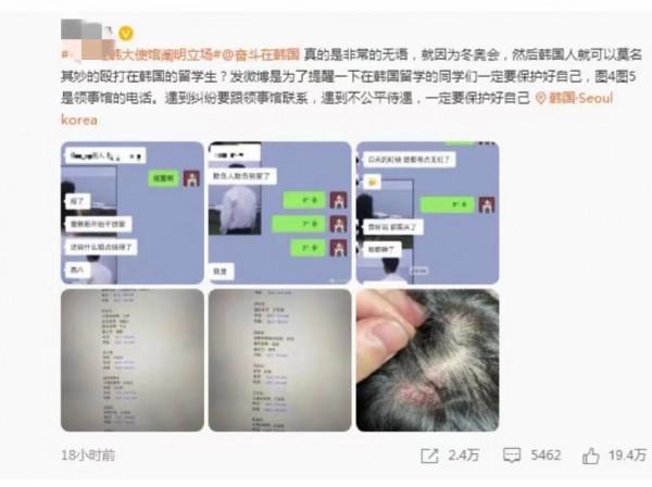 中國留學生在韓被打，大使館緊急出手，體育政治化，太low