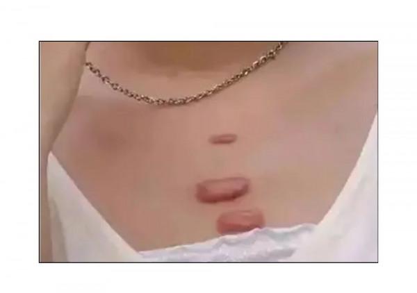 漫畫科普：“揹負”太多，“疹”的很累！