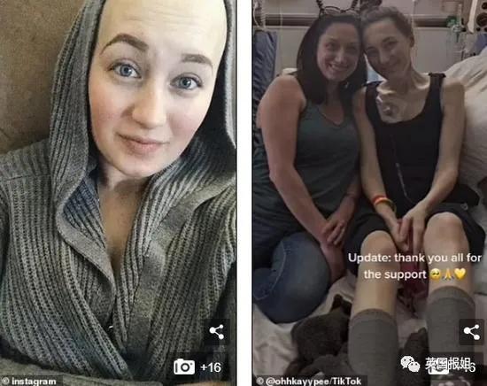 27歲網紅去世面板出狀況沒管三年後癌症晚期？