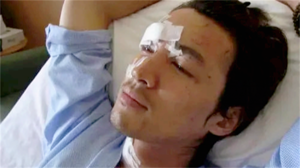 5位“毀容”的明星,胡歌“鬼門關”逃了出來,王心凌令人惋惜 5位“毀容”的明星,胡歌“鬼門關”逃了出來,王心凌令人惋惜