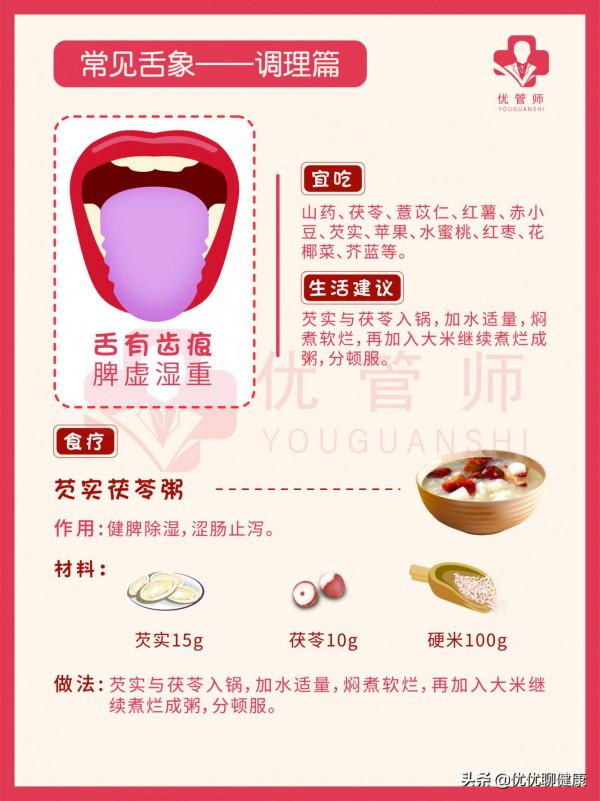 中醫舌診：不同舌相代表著什麼健康問題，如何對症調理？全告訴你
