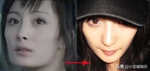 4位女星的整容“塌房路”，有人整成“滅霸”，一個比一個不自然