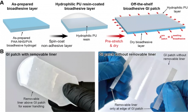 華科校友研發可降解&OpenCurlyDoubleQuote;腸道創可貼&rdquo;，能用於胃腸道缺損無縫修復