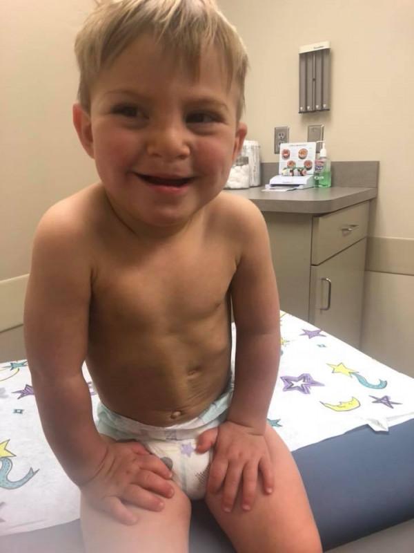 父母不顧醫生建議拒絕墮胎，重度唇顎裂的寶寶現在長成美男了