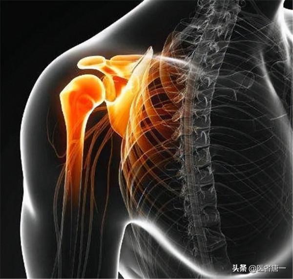 肩周炎能不能自愈?能不能被治癒? 肩周炎能不能自愈?能不能被治癒?