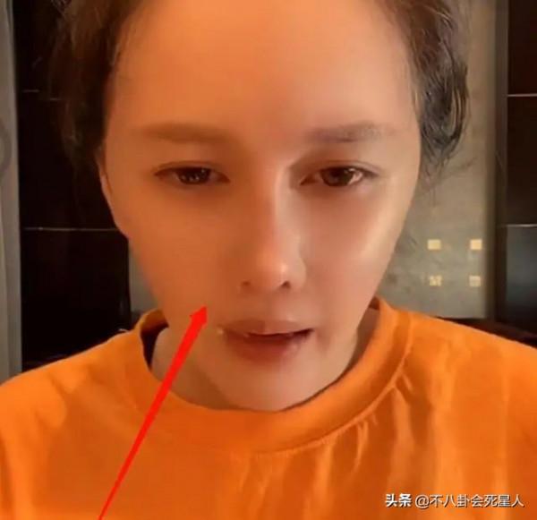 ​瘦到病態、動臉成癮、強行裝嫩，內娛的畸形審美真可怕