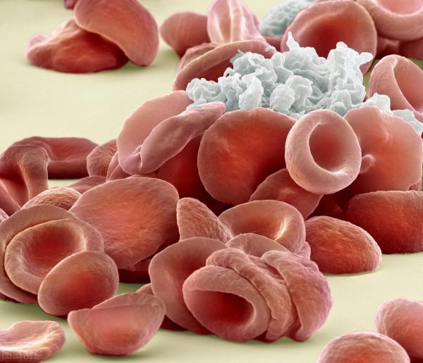 冠狀動脈狹窄50%不放支架怎樣治?醫生為您答疑解惑 冠狀動脈狹窄50%不放支架怎樣治?醫生為您答疑解惑