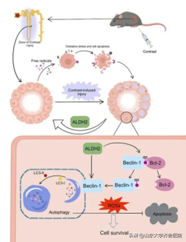 齊魯醫院陳玉國和徐峰團隊揭示改善急性腎損傷新靶點