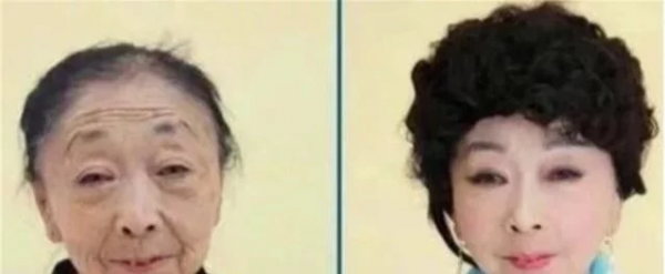 為嫁給25歲小鮮肉，60歲老太太做整容手術，二人現狀如何？