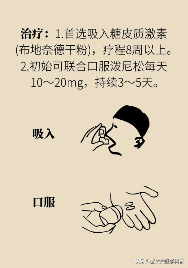 長期慢性咳嗽怎麼回事？（上）