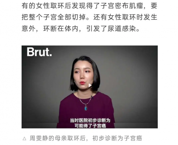 “殘害一代中國女性”的節育環,今日我想為它說上幾句公道話 “殘害一代中國女性”的節育環,今日我想為它說上幾句公道話