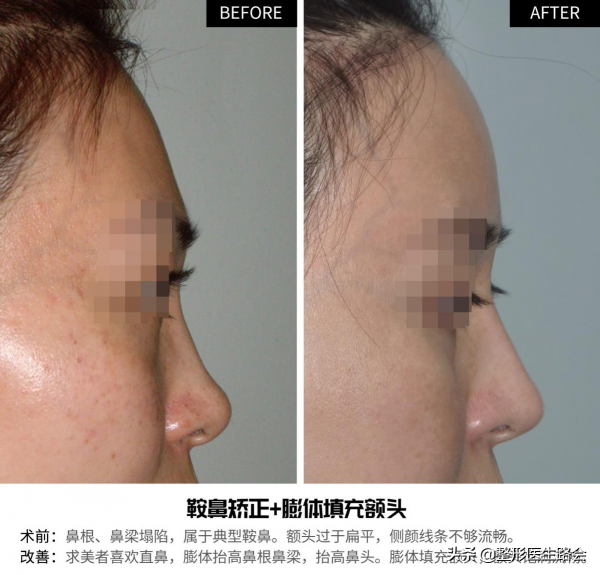 從事醫美整形工作30+年，談談我眼中的男女審美差異？