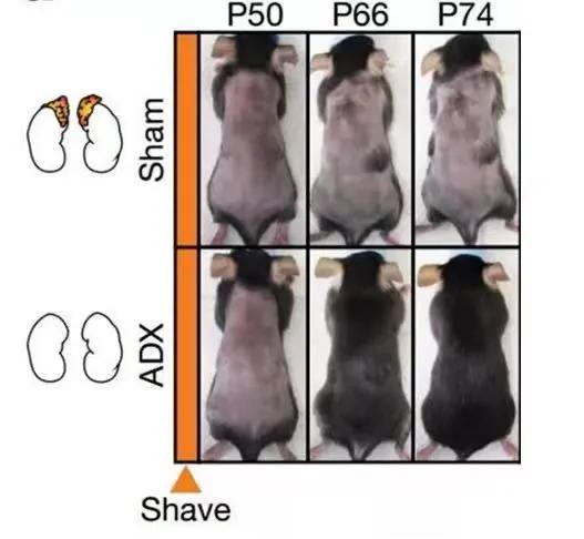 研究發現少白頭可能有機會復黑