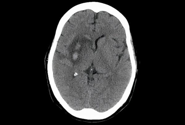 還沉迷於酒的世界嗎？天天喝酒有多可怕，快看看