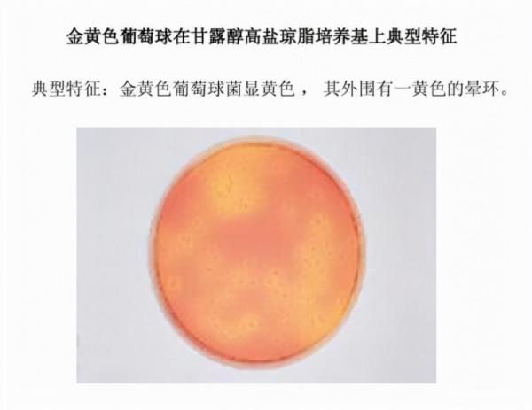 食源性致病菌,原來是你在搗亂 食源性致病菌,原來是你在搗亂