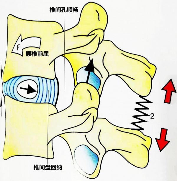 燕飛式-腰部後伸鍛鍊方式的缺陷
