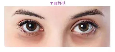 眼霜到底是不是交智商稅？答案出來了