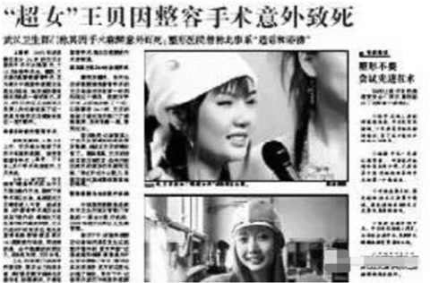 被整容毀了的7位明星，雖各有各的苦衷，卻都美麗盡失、事業滑坡