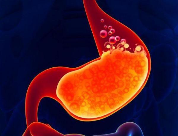 教你如何看胃鏡報告，提醒：報告若出現這3個詞，請提高警惕