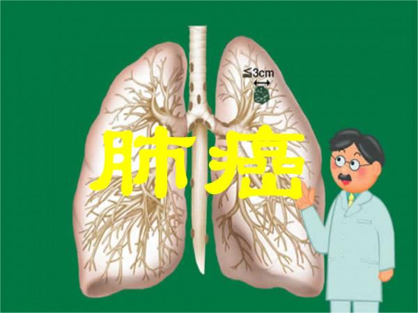 小細胞肺癌患者的飲食吃什麼？