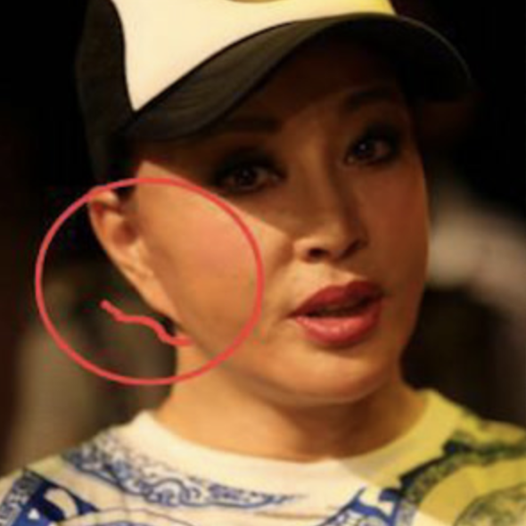 臉僵如石、腫成發麵饅頭，這7位女星動臉後變“災難現場”