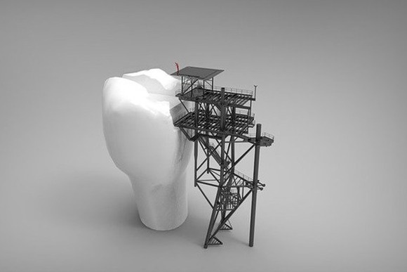 看個牙動輒上萬,牙科診所真的在坑人嗎?怎樣節約成本? 看個牙動輒上萬,牙科診所真的在坑人嗎?怎樣節約成本?