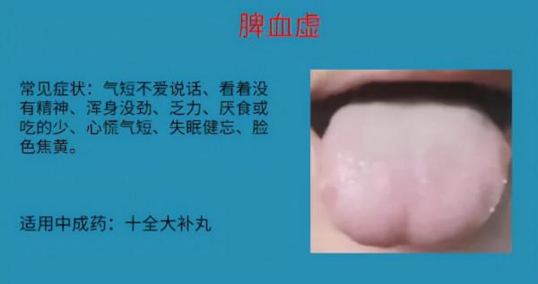 怕冷就補陽？血虛也會！6種血虛情況，實用中成藥大總結