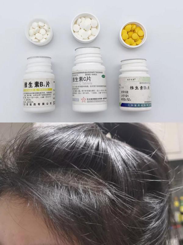 養髮我悟了姐妹們!小碎髮長出來啦 養髮我悟了姐妹們!小碎髮長出來啦