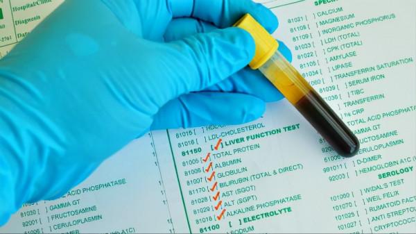 長期服藥的人，當心藥物性肝損傷！這幾種藥易傷肝，儘量別亂吃