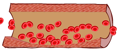 透析相關用藥大全!收藏 透析相關用藥大全!收藏