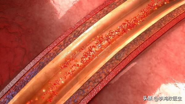 女子胸悶,就醫時測不到血壓摸不著脈搏,醫生:東方美人病 女子胸悶,就醫時測不到血壓摸不著脈搏,醫生:東方美人病