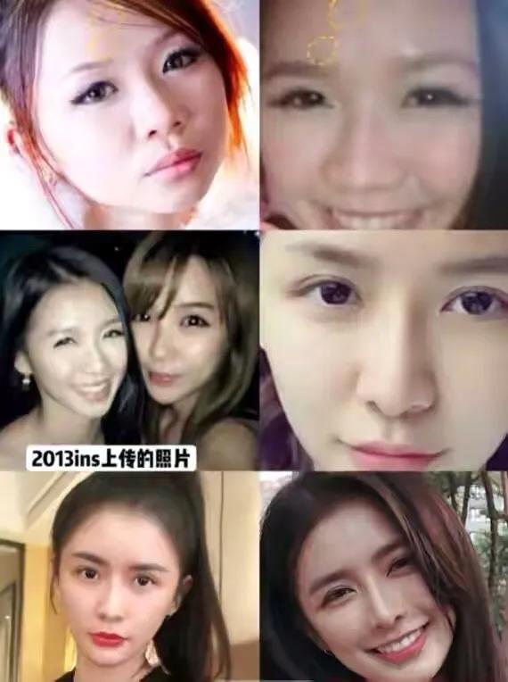 明星出道前後，你覺得誰出道前最好看