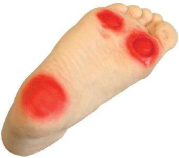 糖尿病足這三類情況你瞭解嗎，點進來，看看你屬於哪一種