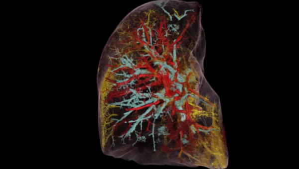 世界上最亮的X射線帶來醫學成像革命