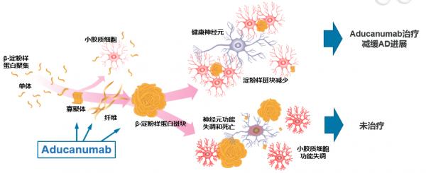 沈璐教授:阿爾茨海默病抗β澱粉樣蛋白治療進展丨NCN2021 沈璐教授:阿爾茨海默病抗β澱粉樣蛋白治療進展丨NCN2021