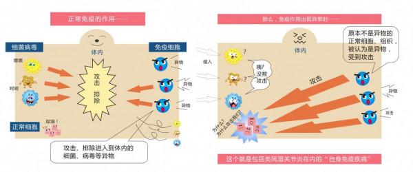 免疫淨化對類風溼患者有何幫助？給血液洗洗澡也能促進康復