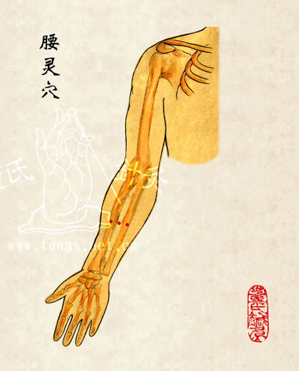 董氏奇穴治療“閃腰”經驗方